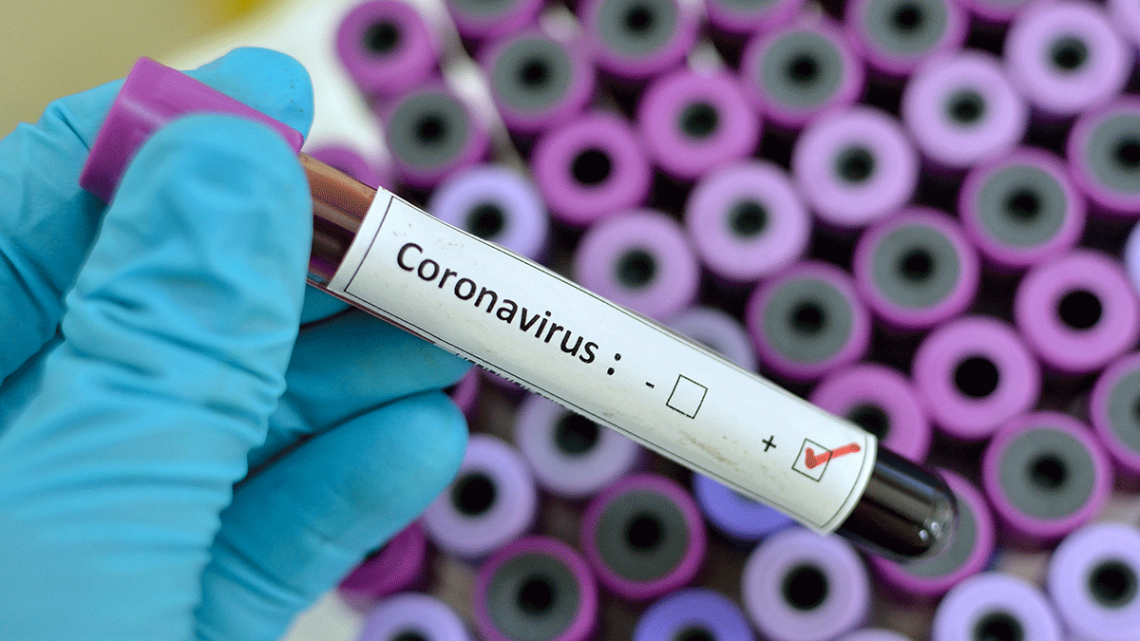 Coronavirus: Forscher in Honkong machen große Fortschritte bei der Entwicklung eines Heilmittels