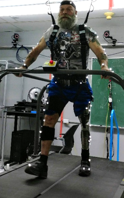 Artificial intelligence brings movement to the world of prostheses