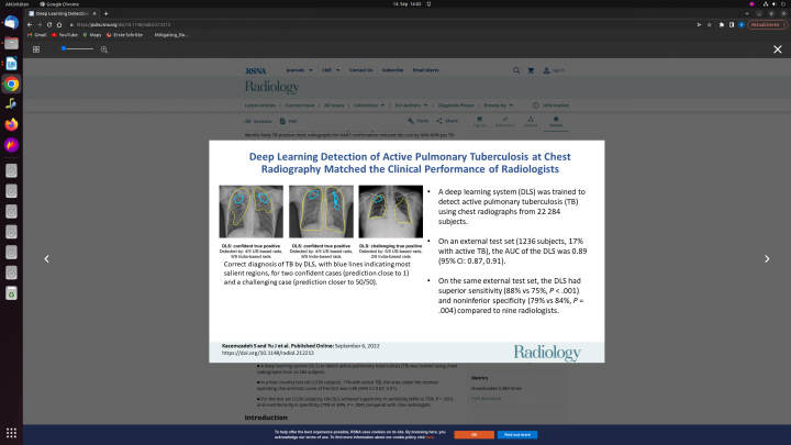 Ki – system detects tuberculosis as well as human radiologists